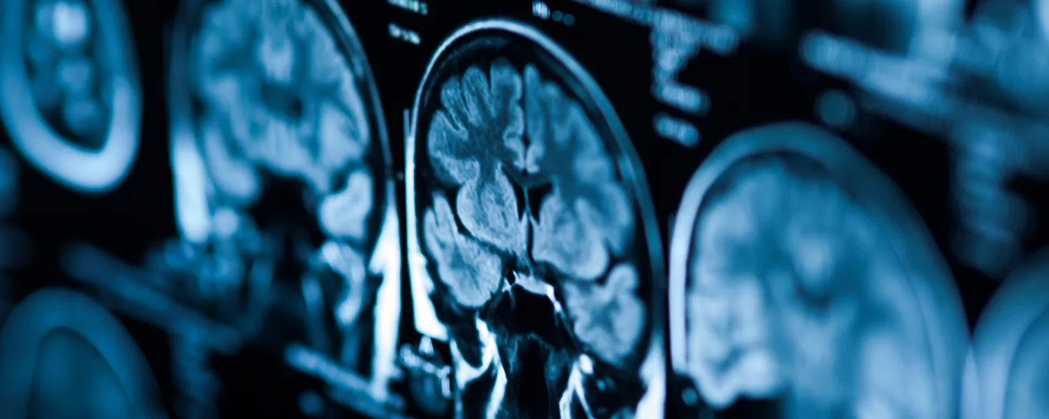 Ct Scan